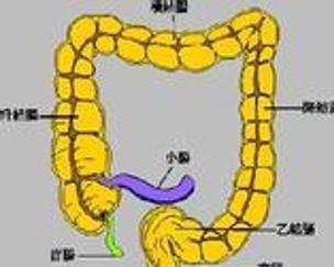 乙状结肠