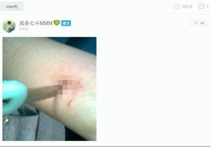 EXO粉丝在贴吧自残图