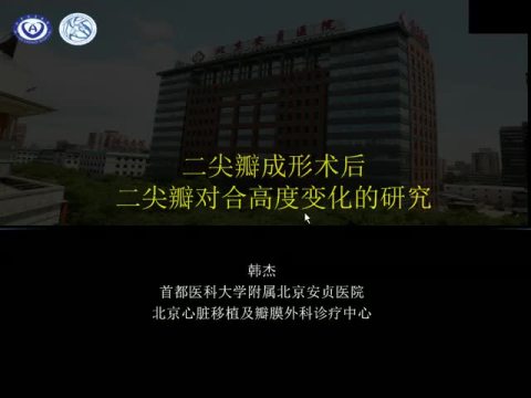 二尖瓣成形术后二尖瓣对合高度变化的研究