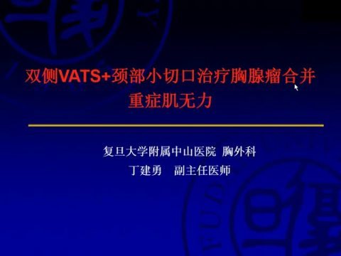 双侧胸腔镜+颈部小切口治疗重症肌无力合并早期胸腺瘤的初步探索