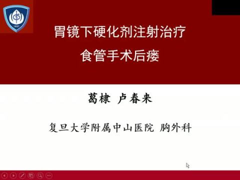 胃镜下硬化剂注射治疗食管手术后瘘经验报道