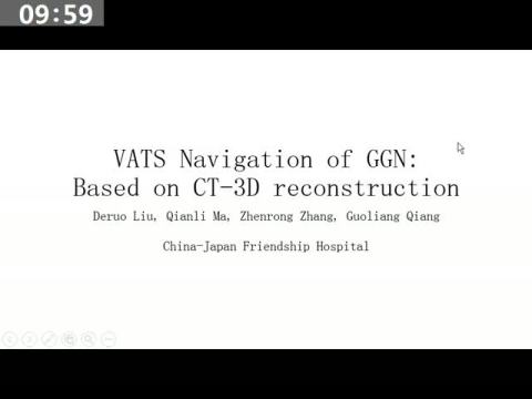 CT三维重建在胸腔镜微创外科中精确定位肺GGO的有效性