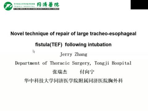 Novel technique of repair of large tracheo-esophageal fistula