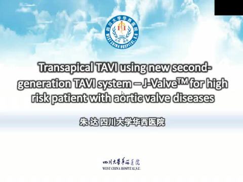 Trans-apical trans-catheter aortic valve implantation using a new second-generation TAVI system - J-ValveTM for high-risk patients with aortic valve disease: initial results with 90-days follow-up.