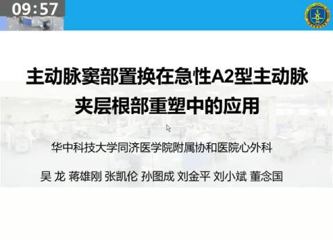 主动脉窦部成形在急性A型夹层主动脉根部重建的应用