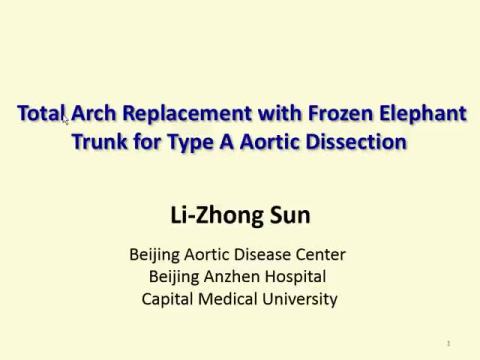 Total Arch Replacement with FET for Acute Type A Aortic Dissection