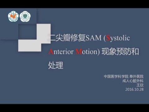 二尖瓣修复SAM(Systolic Anterior Motion) 现象预防和处理