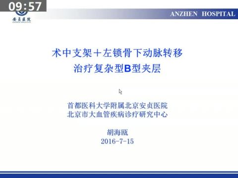 术中支架＋左锁骨下动脉转移治疗复杂型B型主动脉夹层