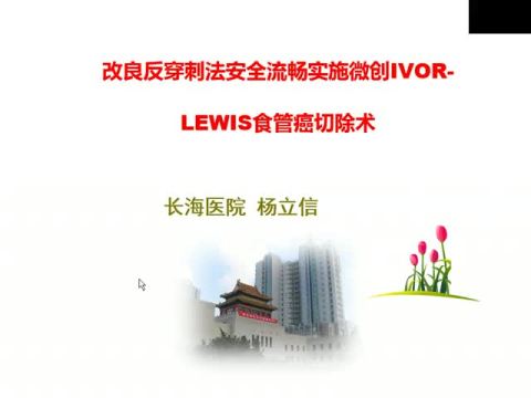 改良反穿刺法胸内吻合安全顺畅实施微创IVOR LEWIS 食管癌切除手术