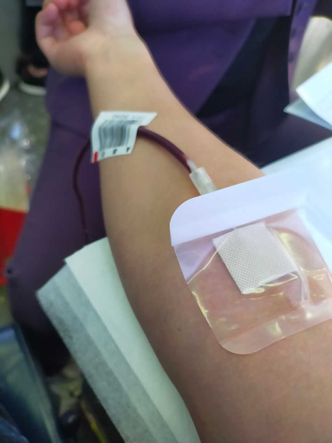 献血的照片真实 手上图片