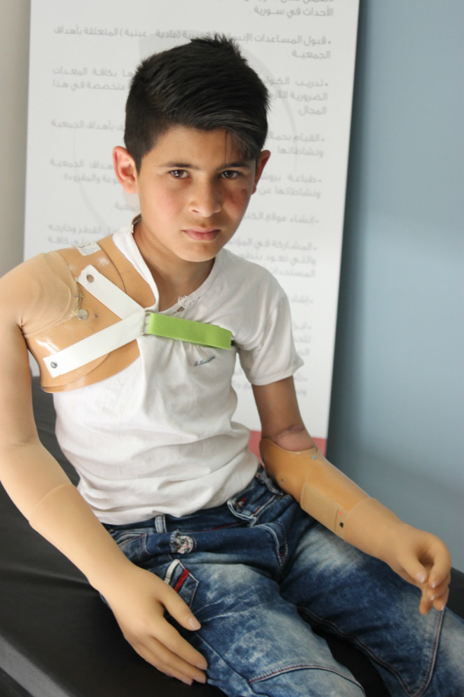 失去双臂的小男孩在假肢安装之后,第一次