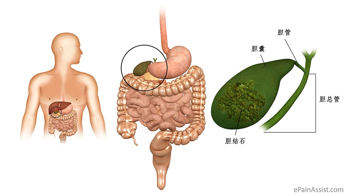 人胆图片,人胆结石图片_大山谷图库