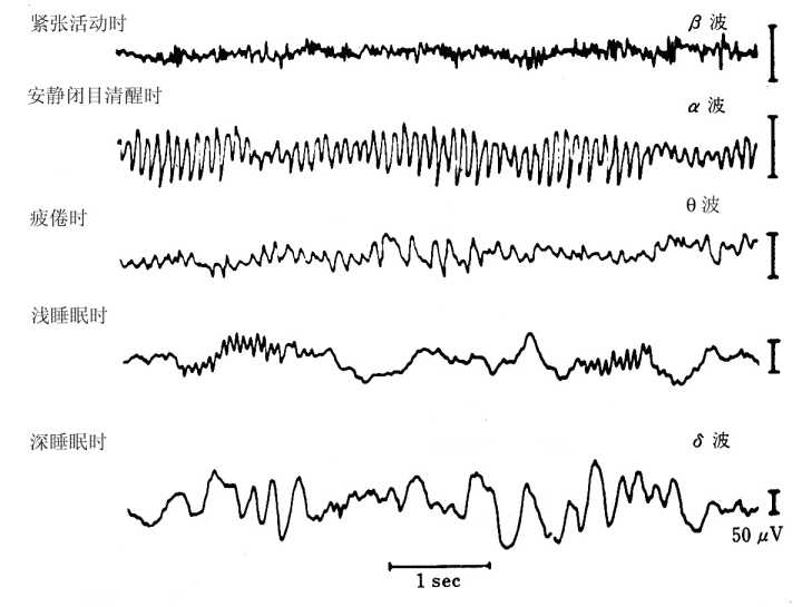 人的脑电波处在阿尔法波状态时是最佳学习工作状态